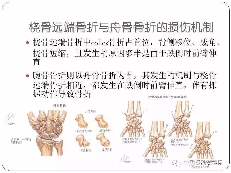 儿童运动损伤报告：过度训练问题突出的简单介绍